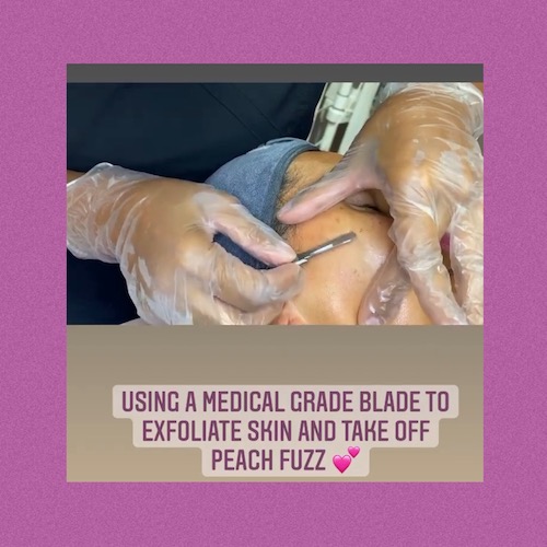 Miini Facial and Dermaplane