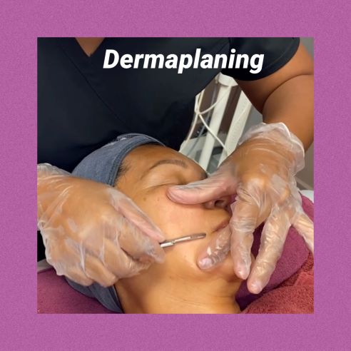 Dermaplaning