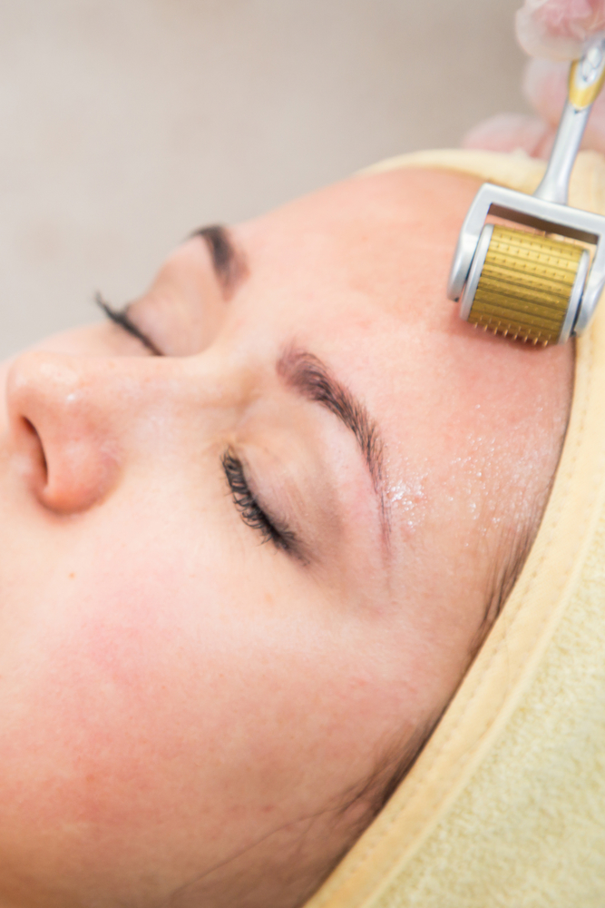 Microneedling: Fight Aging with Your Body’s Natural Healing Abilities