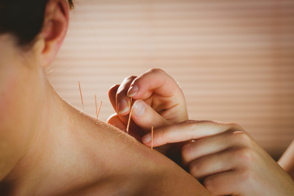 Get Help for Pain and Stress-Related Symptoms with Acupuncture