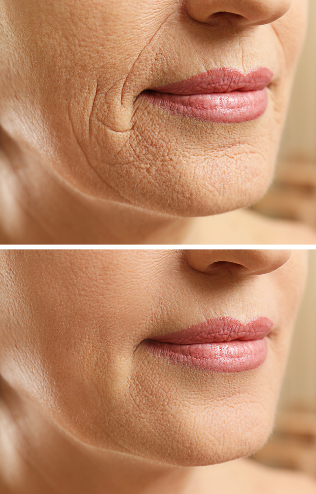 Look Younger Instantly with Microcurrent Facial Treatments