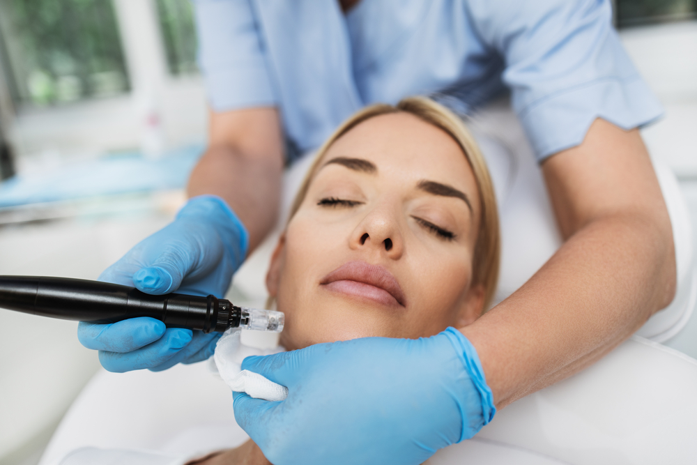 Address a Number of Skin Issues with Microneedling