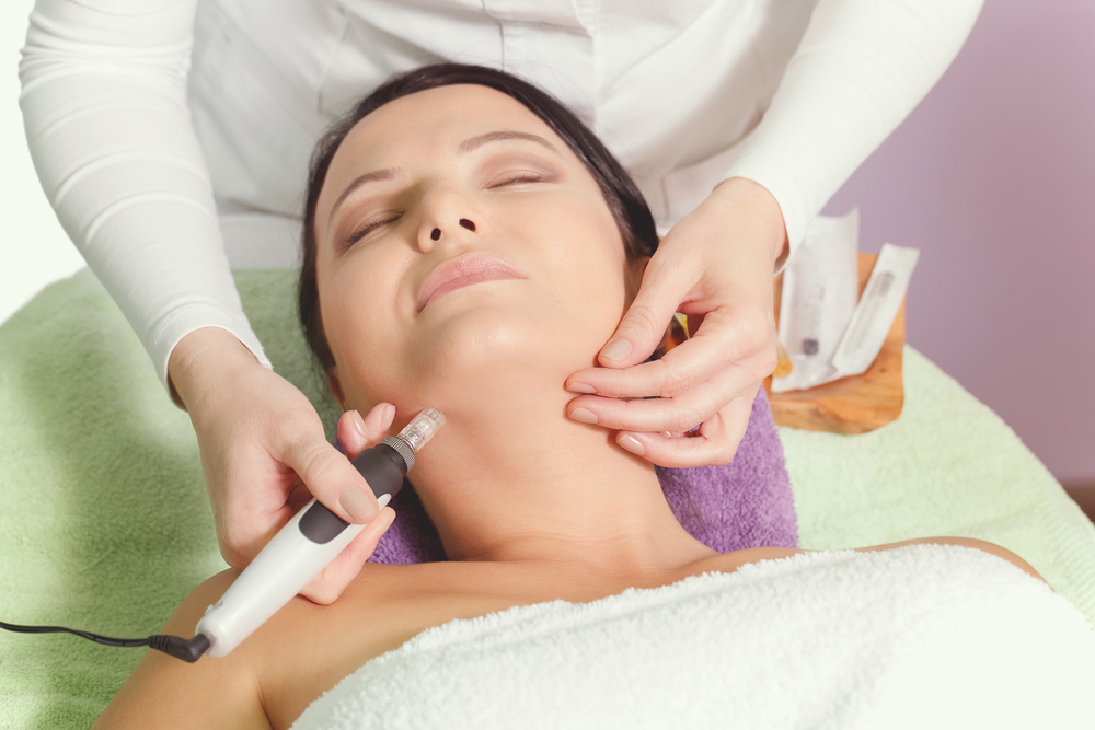 Improve the Look and Feel of Skin with Micro-Needling