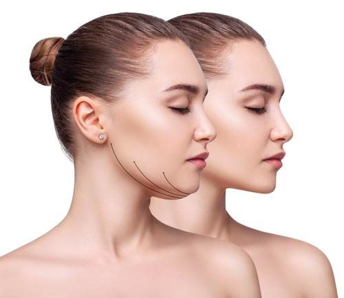 Kybella Treatments: A Revolutionary Solution for Double Chin