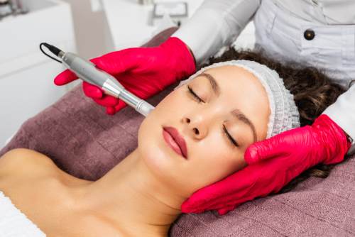 Unlocking the Beauty Secret: Microneedling Unveiled