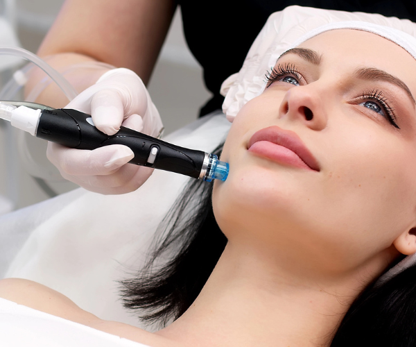 Rediscover Radiance with Microdermabrasion at Helen’s Haven
